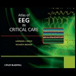 Atlas of EEG in Critical Care