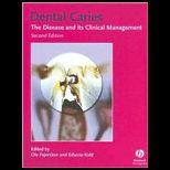 Dental Caries The Disease and Its Clinical Management