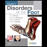 Disorders of Foot