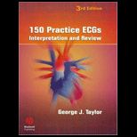 150 Practice ECGs