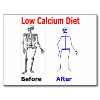 Skeleton on Low Calcium Diet. Post Cards