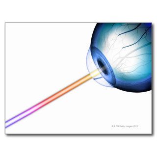 Eyeball Line of Vision Postcards