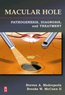 Macular Hole Pathogenesis, Diagnosis, and Treatment, 1e Steven A. Madreperla MD PhD, Brooks W. McCuen II MD 9780750699600 Books