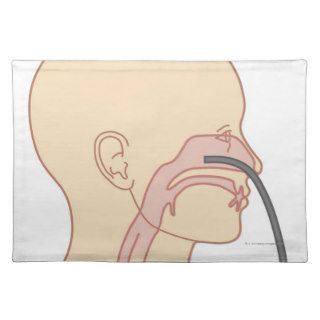 Anterior Rhinoscopy Placemat