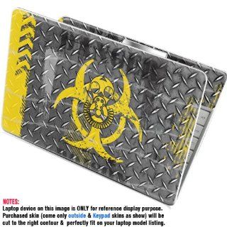 Protective Decal Skin Sticker for Toshiba Satellite L750 L755 L755D (ONLY for "L" Serires) 15.6 in screen case cover L755 Ltop2PS 415 Electronics