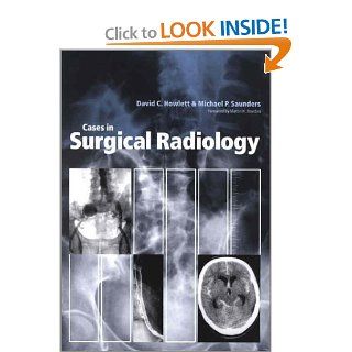 Cases in Surgical Radiology 9780632058228 Medicine & Health Science Books @