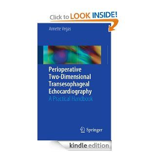 Perioperative Two Dimensional Transesophageal Echocardiography   Kindle edition by Annette Vegas. Professional & Technical Kindle eBooks @ .