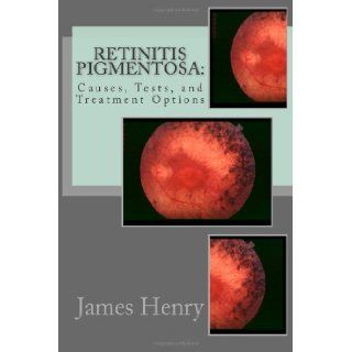 Retinitis Pigmentosa Causes, Tests, and Treatment Options [Paperback] [2012] (Author) James Henry MA, Jeremy Norville MD Books