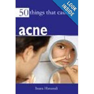 50 Things That Cause Acne Inara Hasanali 9788131911372 Books