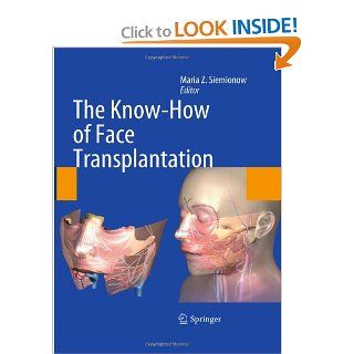 The Know How of Face Transplantation (9780857292520) Maria Z. Siemionow Books