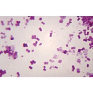 Haemophilus influenzae, w.m., Microscope Slide