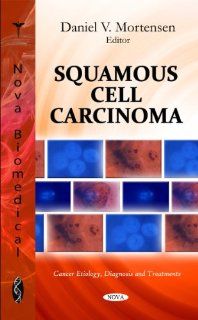 Squamous Cell Carcinoma (Cancer Etiology, Diagnosis and Treatments) 9781612099293 Medicine & Health Science Books @