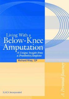Living with a Below Knee Amputation A Unique Insight from a Prosthetist/Amputee 9781556426926 Medicine & Health Science Books @