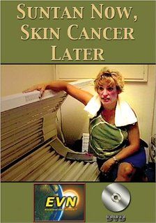 Suntan Now, Skin Cancer Later DVD Artist Not Provided Movies & TV
