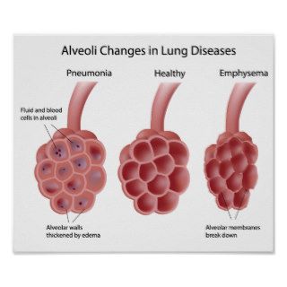 lung diseases Poster