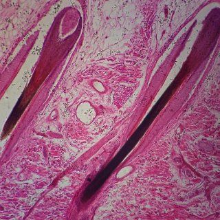 Mammal Hairy Skin sec. 7 m H&E stain, Microscope Slide