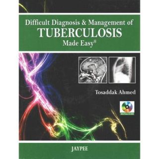 Difficult Diagnosis and Management of Tuberculosis Made Easy